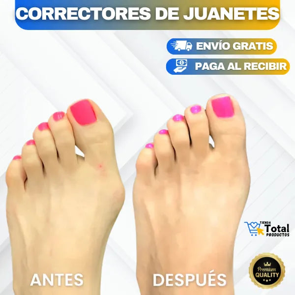 KIT 2 UNIDADES CORRECTORES DE JUANETES + Envío Gratis y Pago Contraentrega 🚚